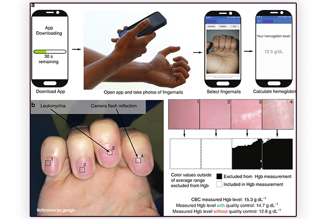 Point of Care Diagnostics