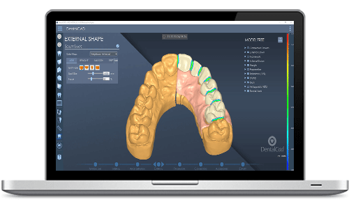 CAD software for dentists 