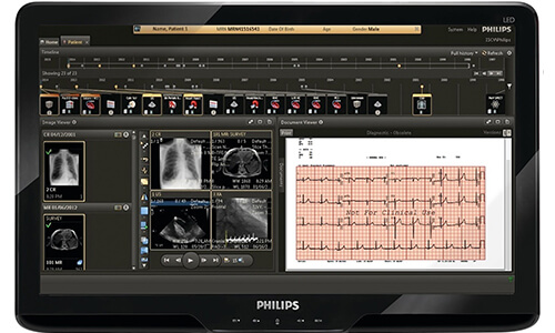 Efficient Cardiovascular Informatics Systems