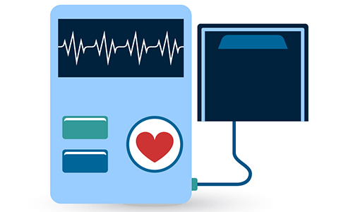 Echocardiography