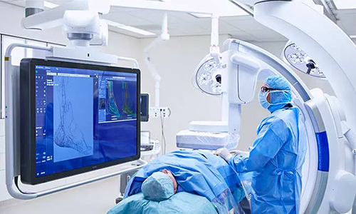 Vascular interventional imaging