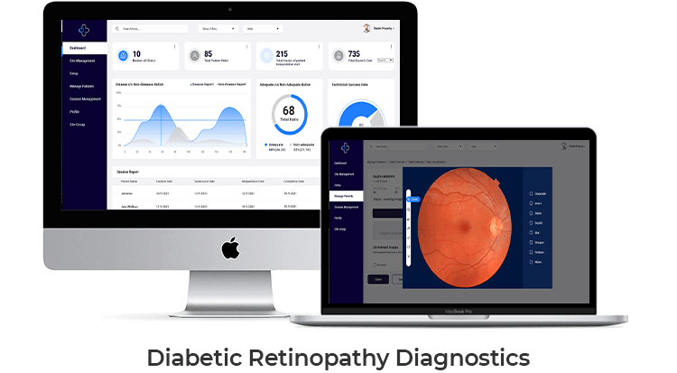 Diabetic Retinopathy Diagnostics Web