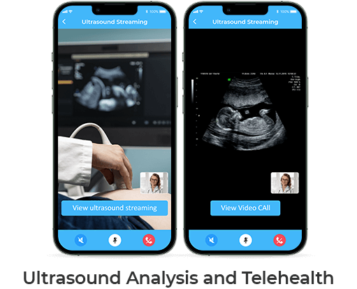 Ultrasound-analysis-and-telehealth